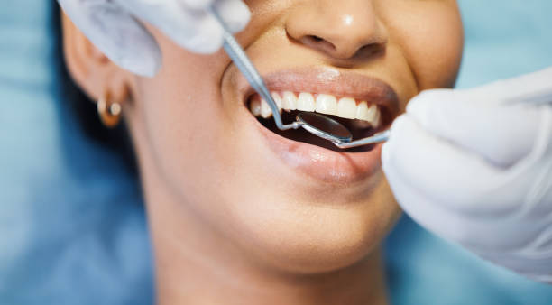 Best Walk-In Emergency Dentist in Boulder, MT