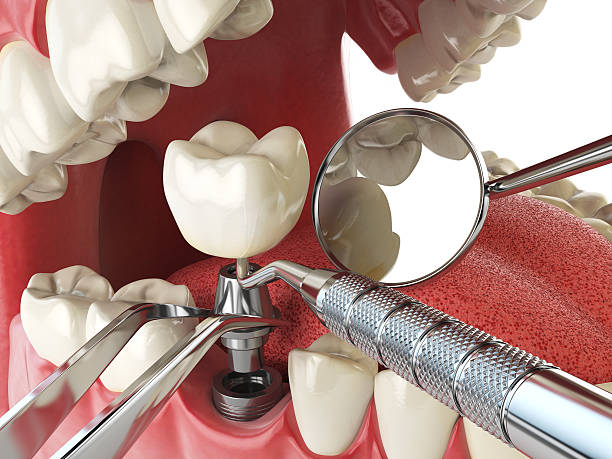 Best Weekend Emergency Dentist in Boulder, MT
